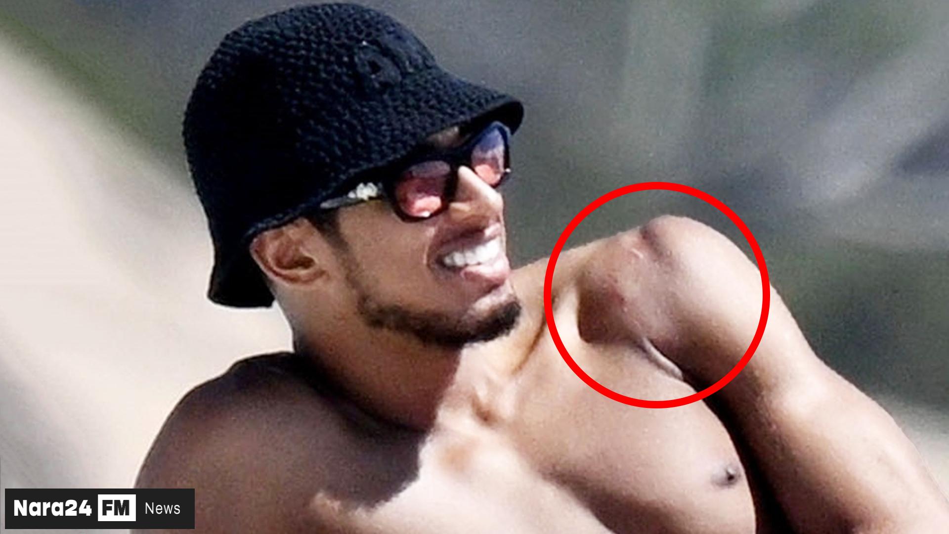 Jude Bellingham Flaunts Shoulder Scar on Luxury Yacht with Girlfriend